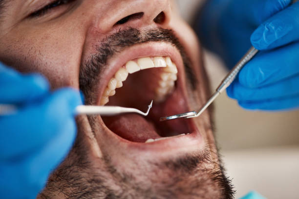 Oral Cancer Screening in Lago Vista, TX